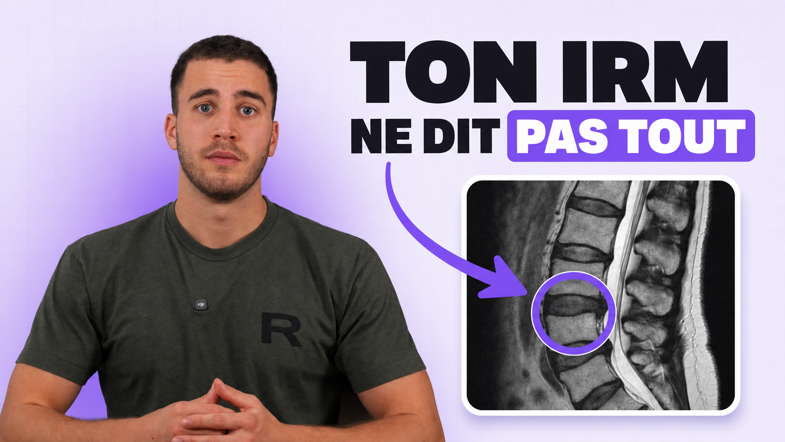 Vidéo : ton IRM ne dit pas tout
